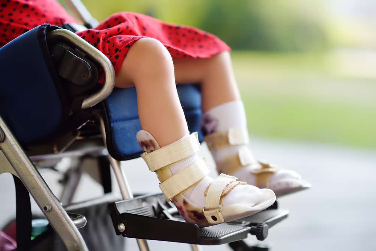 Medical Negligence for Cerebral Palsy Wilson Browne